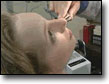 Sinusitis and Antibiotics